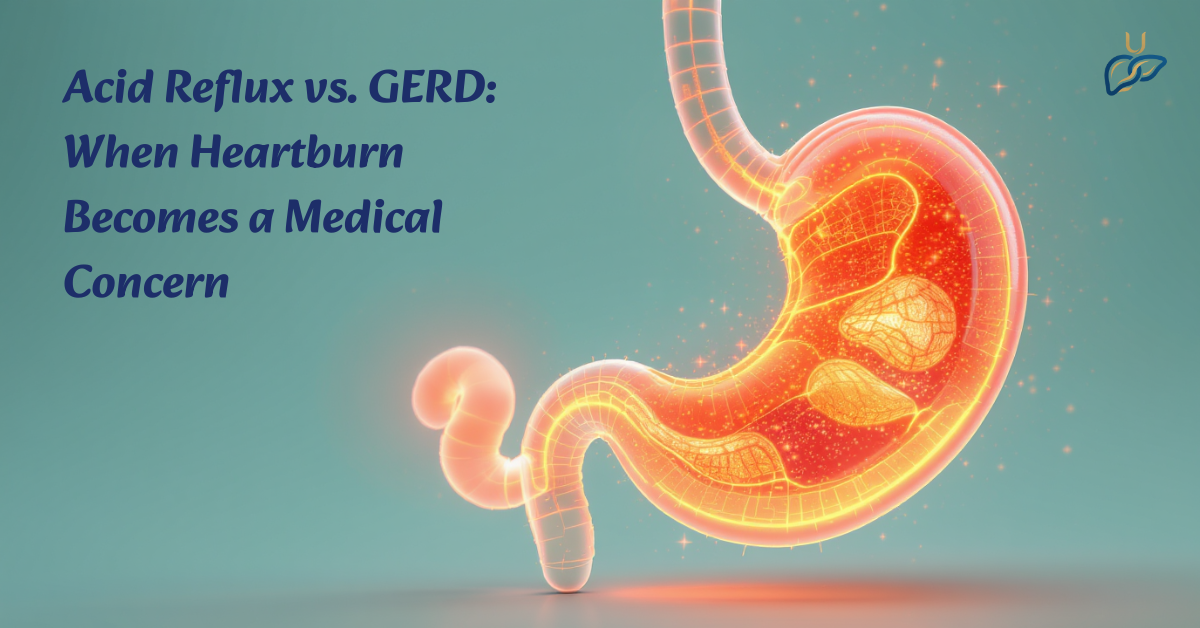 Acid Reflux vs. GERD: When Heartburn Becomes a Medical Concern